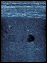 DEGUM Grundkurs - Sonographie