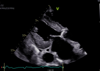 Aufbau- und Refresherkurs Echokardiographie