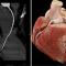 Hochmoderne und präzise Diagnostik dank neuem CT-Gerät